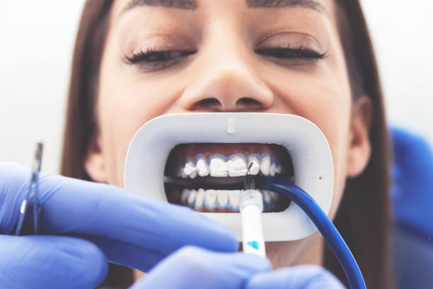 image of a woman during a professional whitening treatment